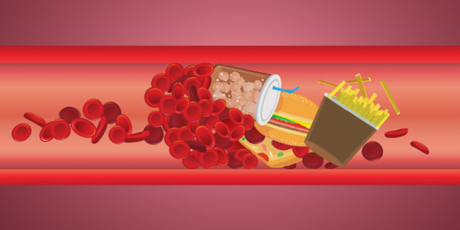 La cattiva alimentazione uccide più del fumo. Come iniziare a combattere l’obesità